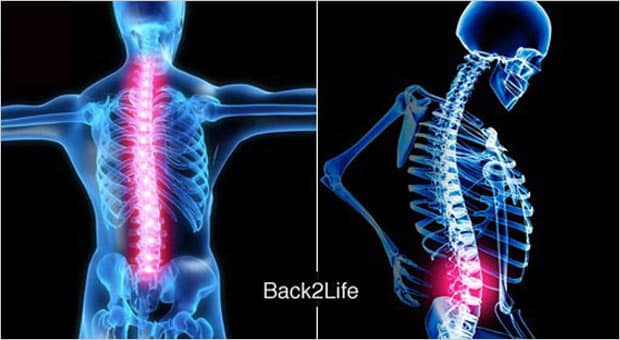 Shoulder or back pain?  shoppers rate this spine alignment